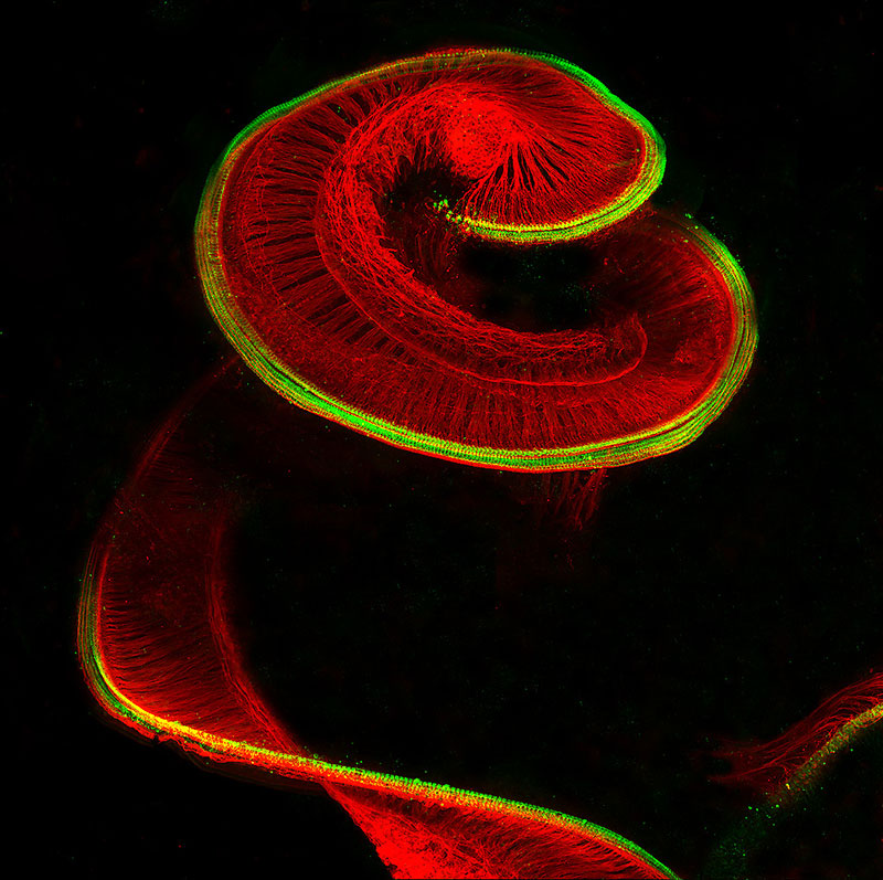 nikon_small_world_08_P4_Rat_Cochlea.jpg